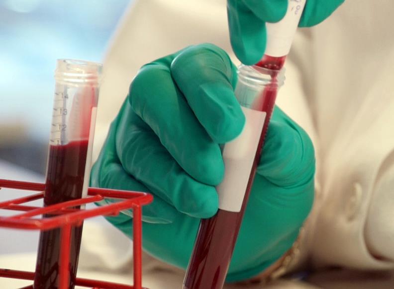 Гемофілія у дітей Гемофілія у дітей