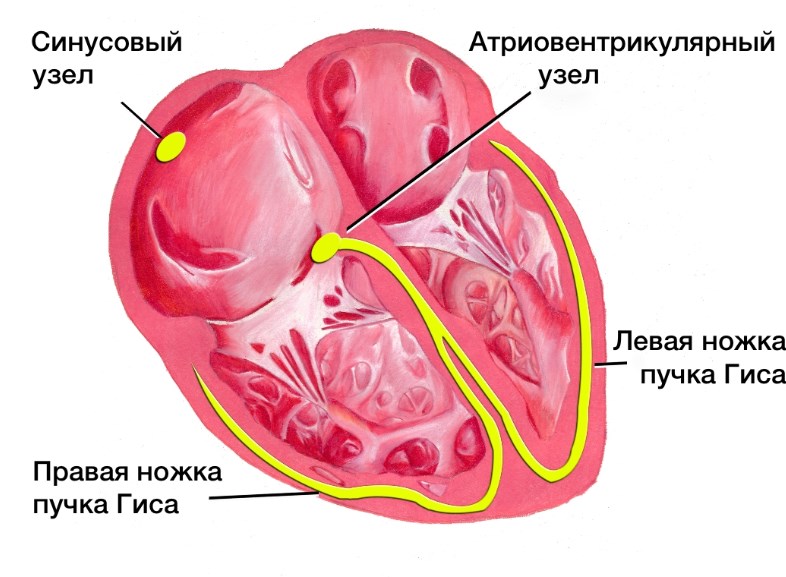 Блокада правої і лівої ніжок пучка Гіса