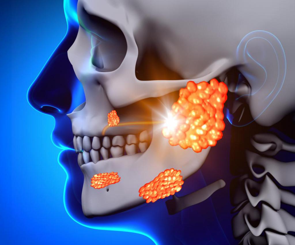 Слини-кам'яна хвороба (калькульозний сіалоаденіт)