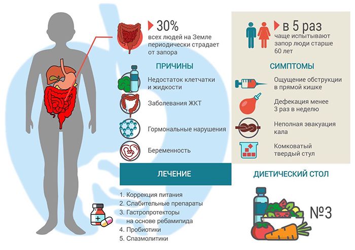 Що таке запор і чому він виникає. Діагностика та лікування запорів