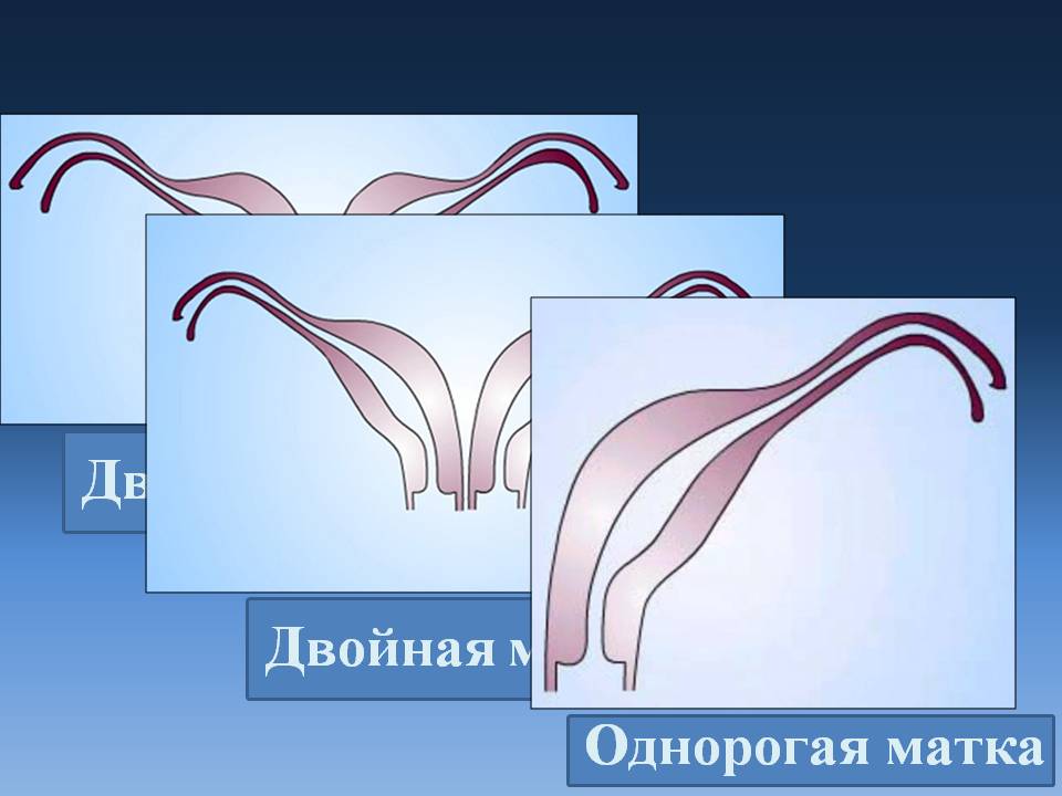 Чому під час рясних місячних виходять згустки крові, схожі на печінку, що робити?