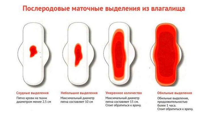 Скільки днів у нормі мають тривати місячні у дівчат та жінок, які відхилення від середніх цифр вважаються патологією?