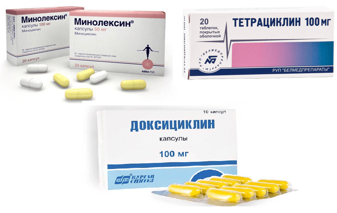 Чи може бути затримка місячних після прийому антибіотика: чи потрібно щось робити?