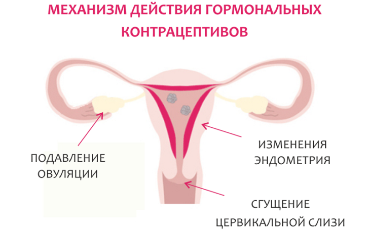 Чому після відміни протизаплідних таблеток чи під час їх прийому немає місячних?